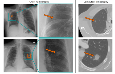 AI diagnostics: New AI system increases accuracy by up to 8 percent